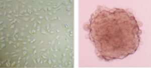 SNB-19 human glioblastoma cells